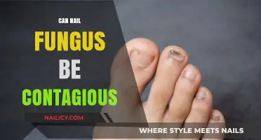 Is Nail Fungus Contagious? Facts and Prevention Tips