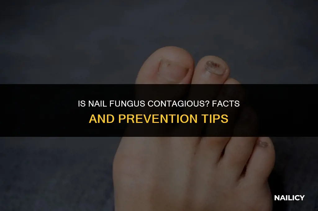 can nail fungus be contagious
