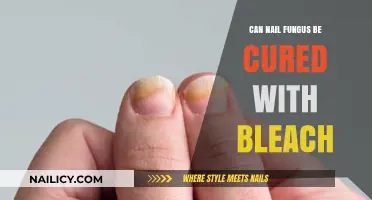 Debunking Myths: Can Bleach Really Cure Nail Fungus?
