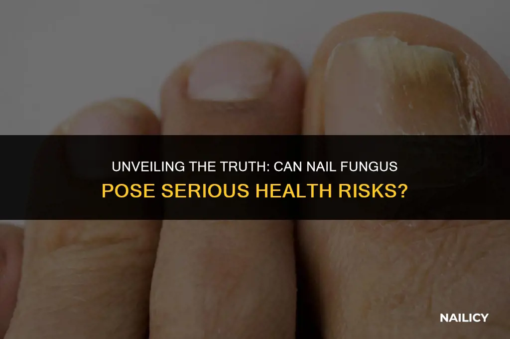 can nail fungus be dangerous