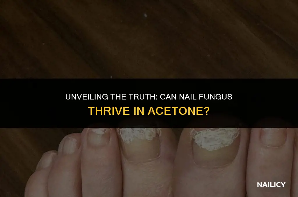 can nail fungus be found in acetone