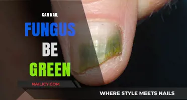 Unveiling the Truth: Can Nail Fungus Really Be Green?