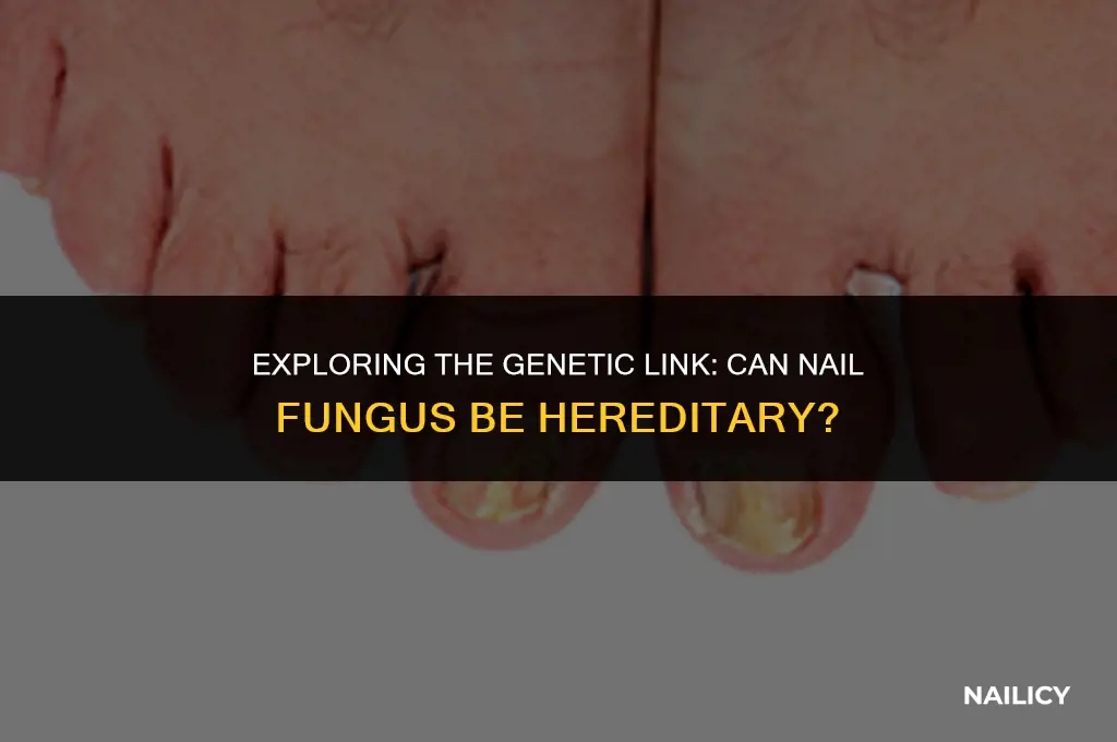 can nail fungus be hereditary
