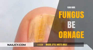 Exploring the Myths: Can Nail Fungus Really Be Orange?