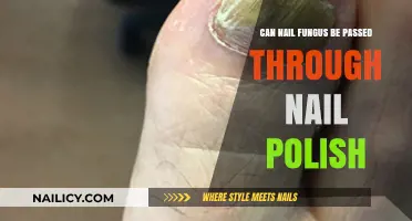 Can Nail Fungus Spread via Shared Nail Polish? Find Out