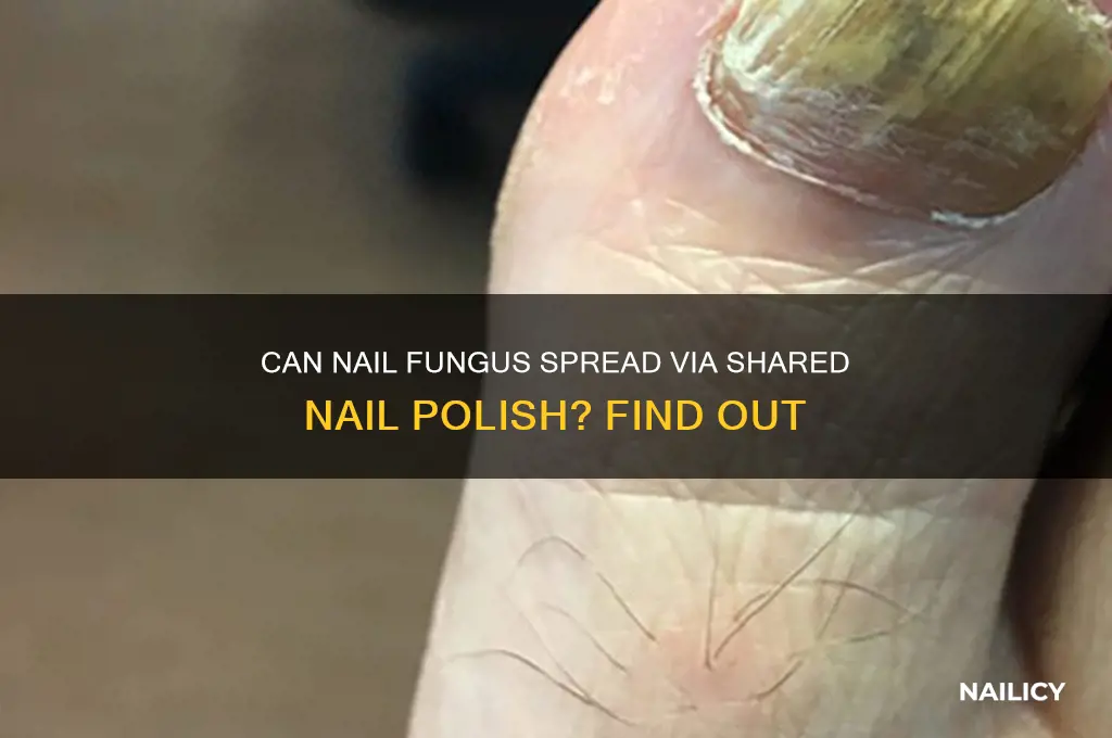 can nail fungus be passed through nail polish