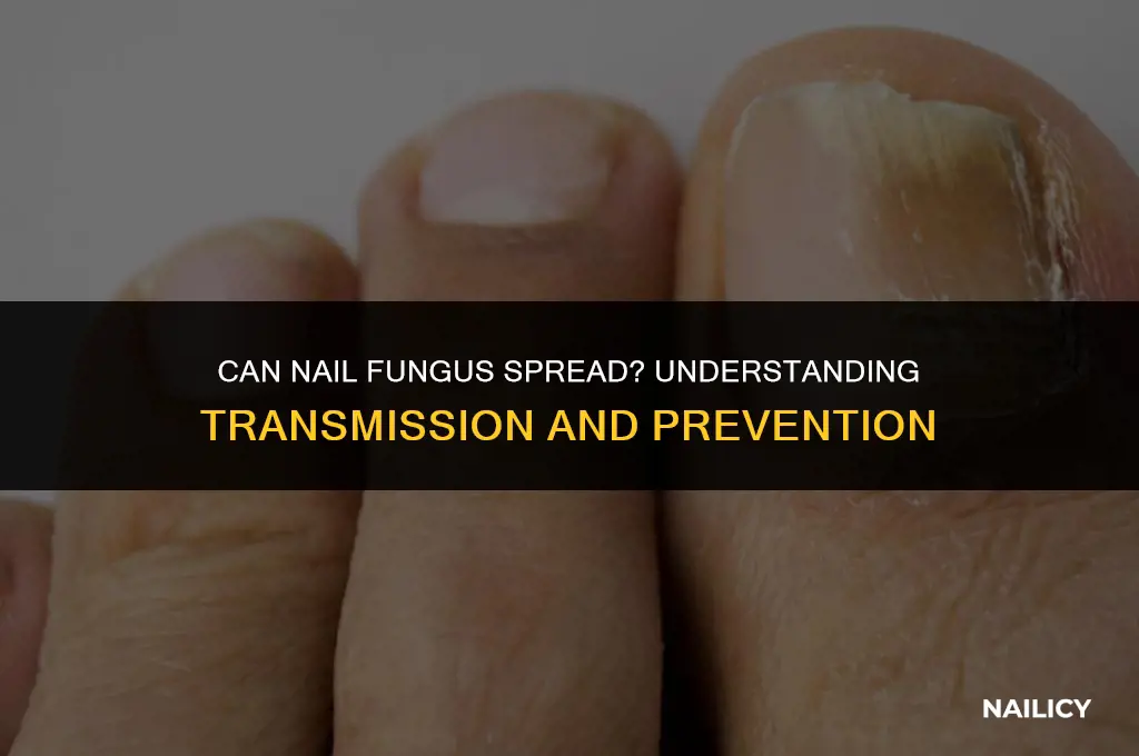 can nail fungus be transmitted to another person
