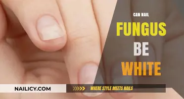 Unveiling the Truth: Can Nail Fungus Really Be White?