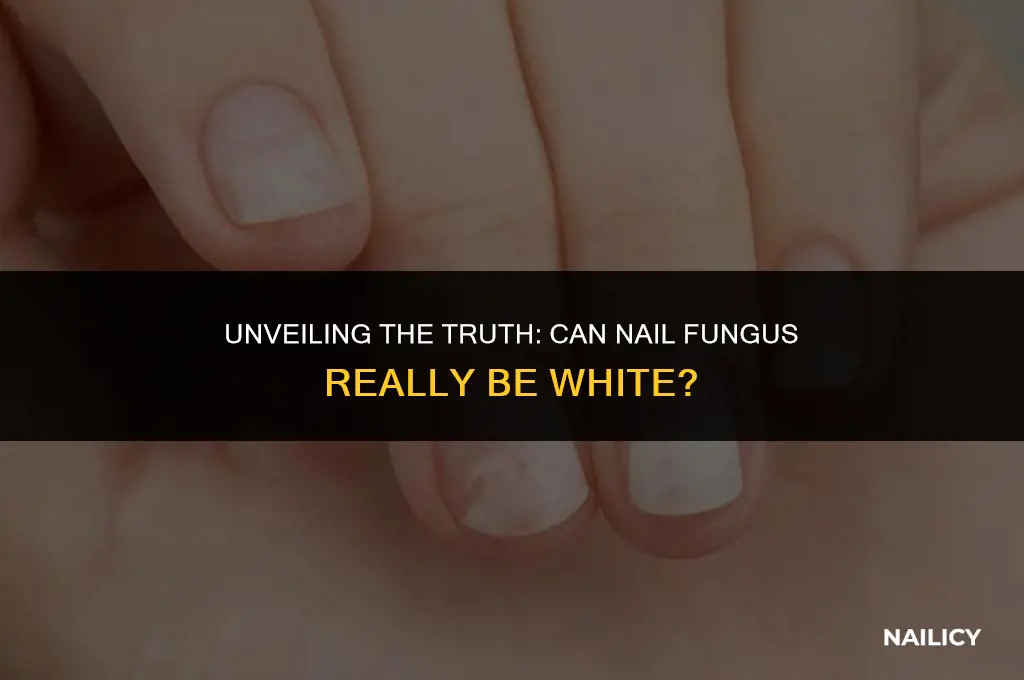 can nail fungus be white