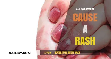 Exploring the Link: Can Nail Fungus Trigger Skin Rashes?