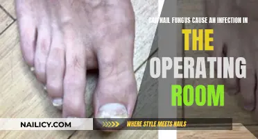 Preventing Nail Fungus Infections in the Operating Room: A Guide