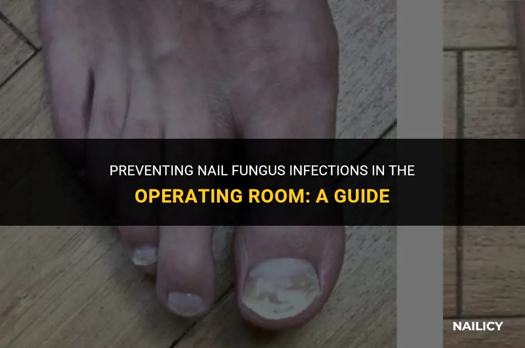 can nail fungus cause an infection in the operating room