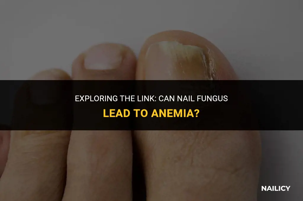 can nail fungus cause anemia