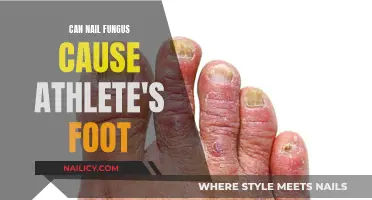 Exploring the Link: Can Nail Fungus Lead to Athlete's Foot?