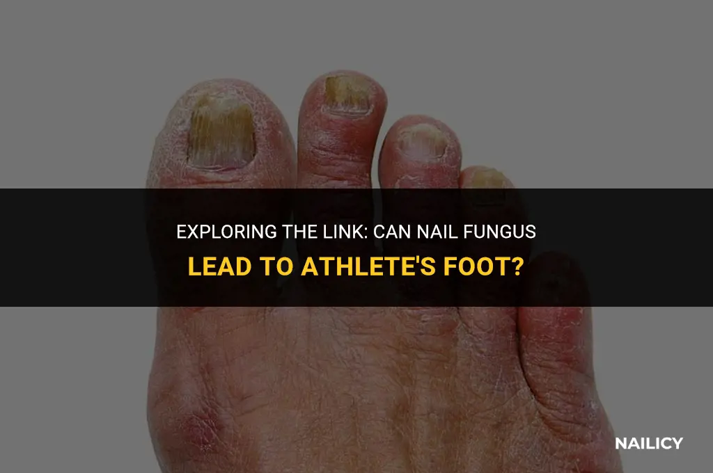 can nail fungus cause athlete