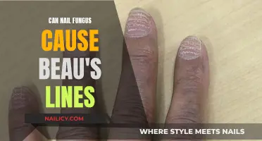 Unveiling the Truth: Nail Fungus and Beau's Lines Connection