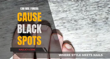 Unveiling the Truth: Nail Fungus and the Mystery of Black Spots