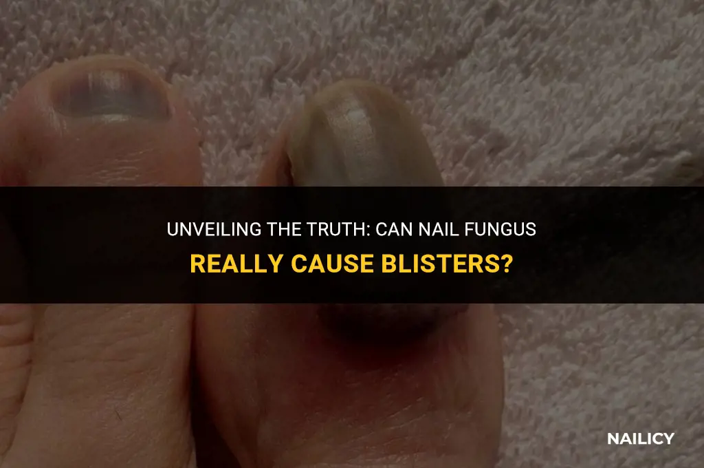 can nail fungus cause blisters