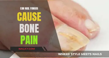 Exploring the Link: Can Nail Fungus Trigger Bone Pain?