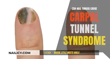 Exploring the Link: Nail Fungus and Carpal Tunnel Syndrome