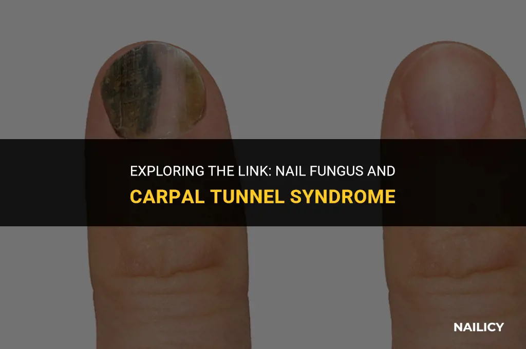 can nail fungus cause carpal tunnel syndrome