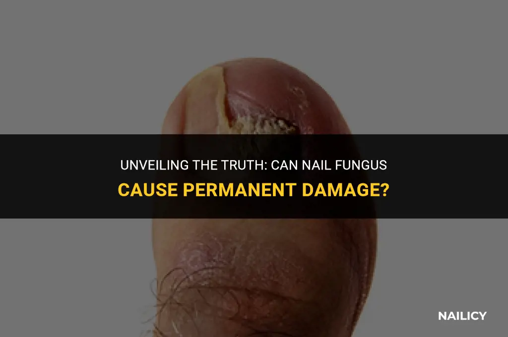 can nail fungus cause damage