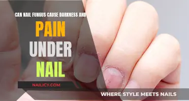 Unveiling the Truth: Nail Fungus and Its Impact on Nail Health
