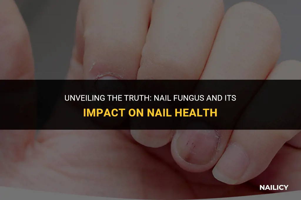 can nail fungus cause darkness and pain under nail