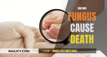 Debunking Myths: The Truth About Nail Fungus and Mortality