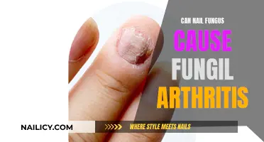 Exploring the Link: Nail Fungus and Fungal Arthritis