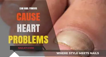 Exploring the Link: Nail Fungus and Potential Heart Complications