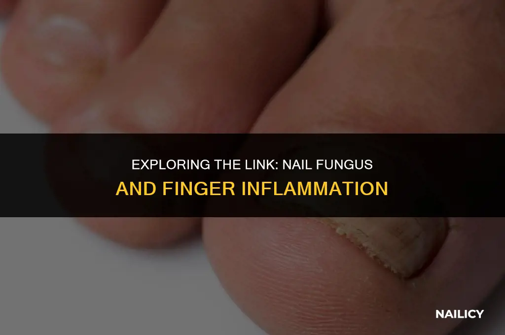 can nail fungus cause inflammation in finger