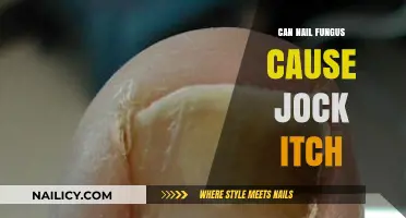 Exploring the Link: Can Nail Fungus Trigger Jock Itch?
