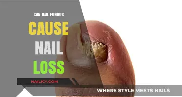 Exploring the Link: Can Nail Fungus Lead to Permanent Nail Loss?