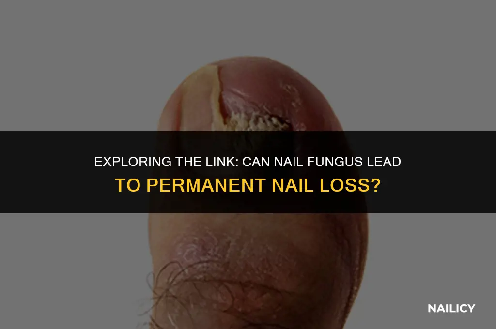 can nail fungus cause nail loss