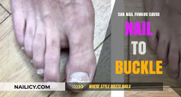 Exploring the Link: Can Nail Fungus Lead to Nail Buckling?