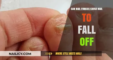 The Truth About Nail Fungus: Can It Really Make Your Nails Fall Off?