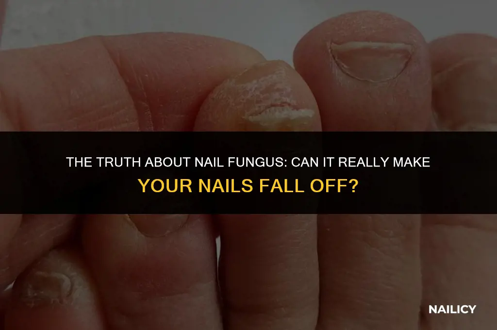 can nail fungus cause nail to fall off
