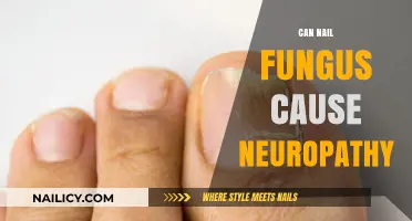 Exploring the Link: Can Nail Fungus Trigger Neuropathy?