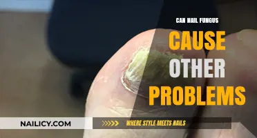 Exploring the Complications: Can Nail Fungus Lead to Further Health Issues?