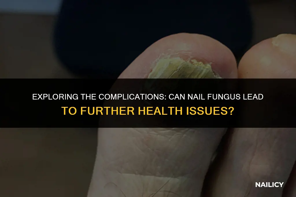 can nail fungus cause other problems