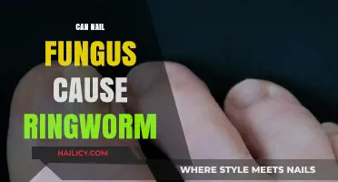 Exploring the Link: Can Nail Fungus Trigger Ringworm?