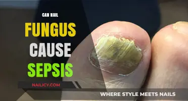 Unveiling the Truth: Can Nail Fungus Lead to Sepsis?