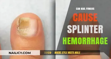 Unveiling the Truth: Nail Fungus and Splinter Hemorrhages Connection
