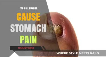 Exploring the Link: Can Nail Fungus Trigger Stomach Pain?