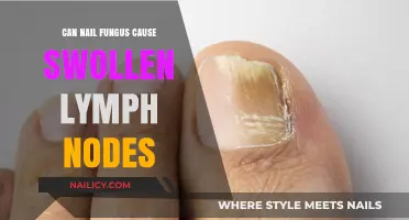 Exploring the Link: Nail Fungus and Swollen Lymph Nodes
