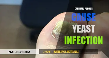 Exploring the Link: Can Nail Fungus Trigger Yeast Infections?