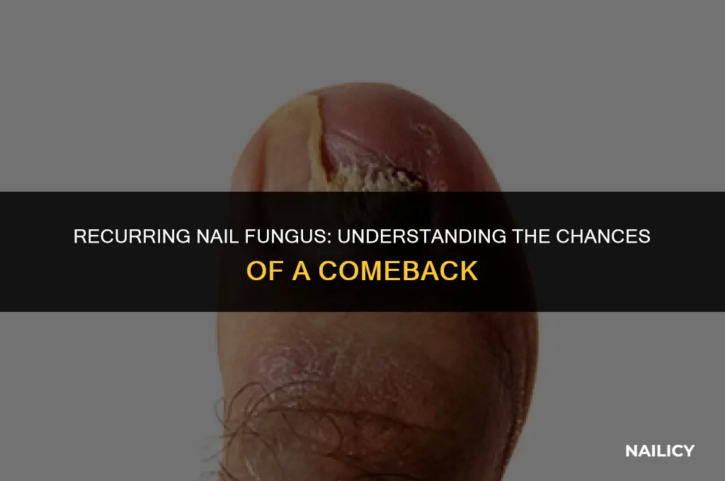 can nail fungus come back