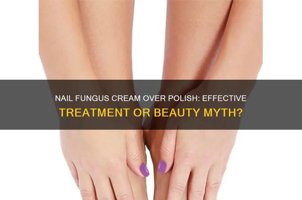 can nail fungus cream go over nail polish