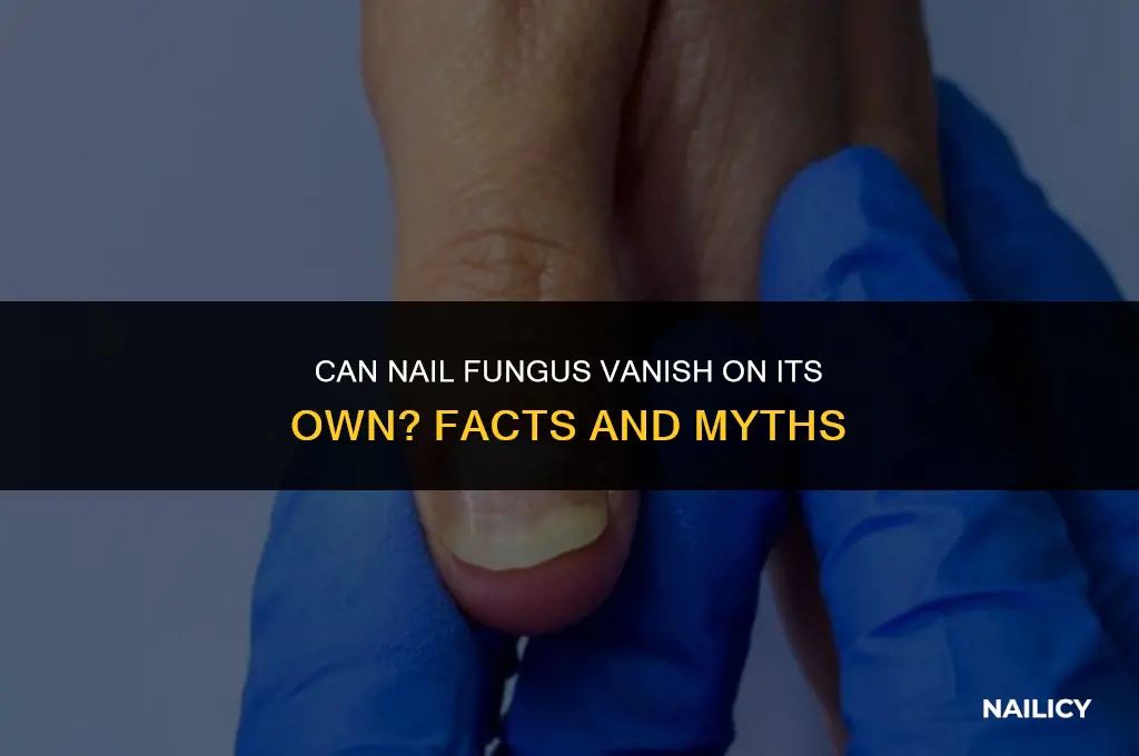 can nail fungus disappear by itself